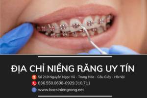 địa chỉ niềng răng uy tín