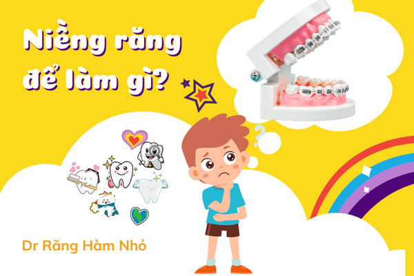 Niềng răng để làm gì