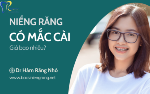 Niềng răng mắc cài giá bao nhiêu