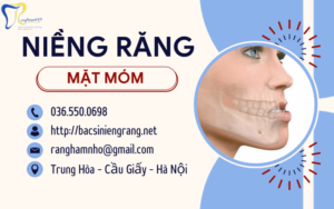 Niềng răng mặt móm