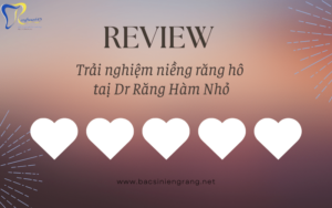 Niềng răng mặt hô